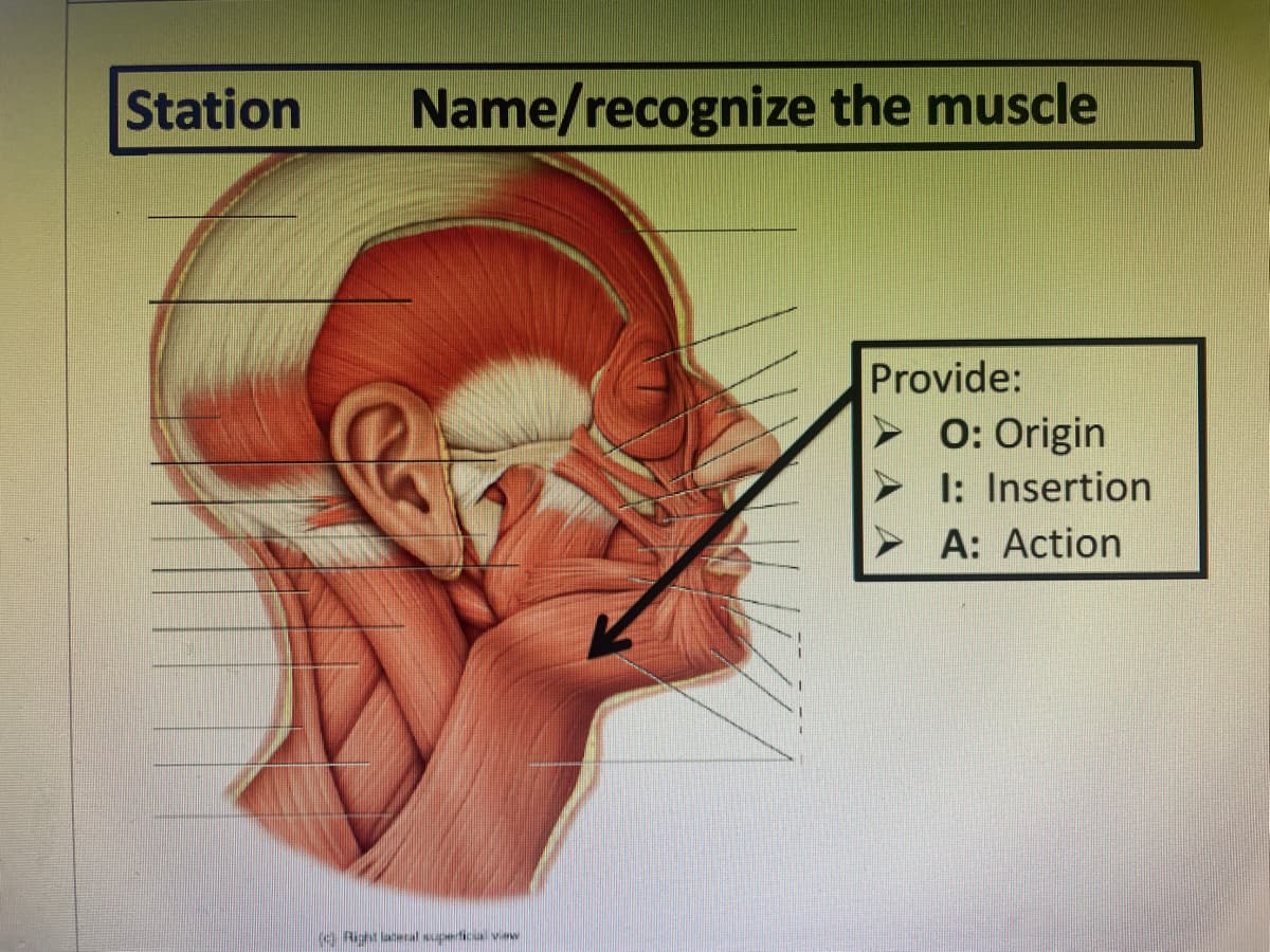 Station
Name/recognize the muscle
Provide:
0: Origin
I: Insertion
A: Action
Richt laceal superticial view
