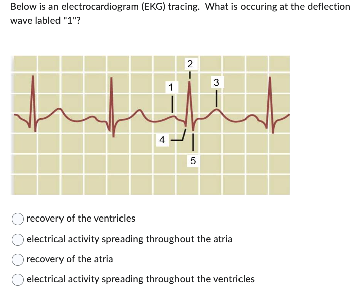 Below is an
wave labled "1"?
electrocardiogram (EKG) tracing. What is occuring at the deflection
با متلب
4
1
2
5
3
recovery of the ventricles
electrical activity spreading throughout the atria
recovery of the atria
electrical activity spreading throughout the ventricles