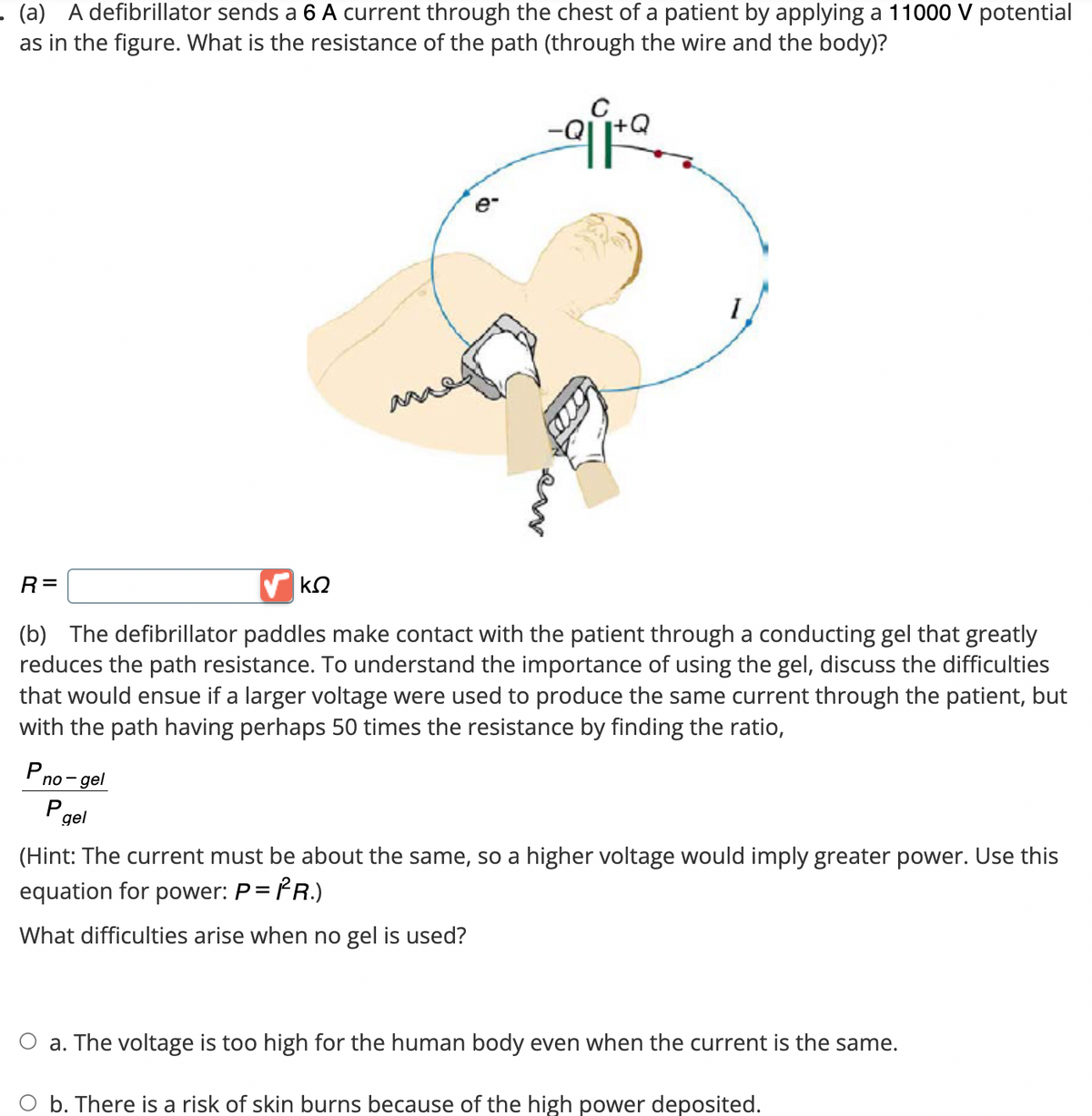 (a)
defibrillator sends a 6 A current through the chest of a patient by applying a 11000 V potential
as in the figure. What is the resistance of the path (through the wire and the body)?
-aira
R=
(b) The defibrillator paddles make contact with the patient through a conducting gel that greatly
reduces the path resistance. To understand the importance of using the gel, discuss the difficulties
that would ensue if a larger voltage were used to produce the same current through the patient, but
with the path having perhaps 50 times the resistance by finding the ratio,
P
no-gel
P
gel
e-
ΚΩ
(Hint: The current must be about the same, so a higher voltage would imply greater power. Use this
equation for power: P = PR.)
What difficulties arise when no gel is used?
a. The voltage is too high for the human body even when the current is the same.
b. There is a risk of skin burns because of the high power deposited.