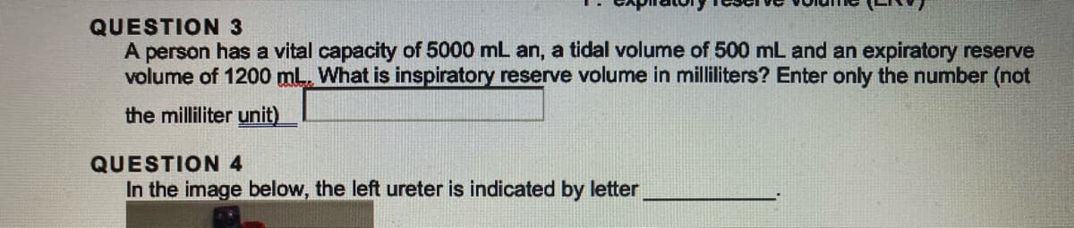 QUESTION 3
A person has a vital capacity of 5000 mL an, a tidal volume of 500 mL and an expiratory reserve
volume of 1200 mL. What is inspiratory reserve volume in milliliters? Enter only the number (not
the milliliter unit)
QUESTION 4
In the image below, the left ureter is indicated by letter