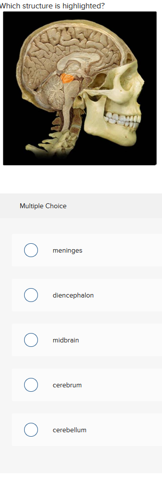 Which structure is highlighted?
Multiple Choice
meninges
diencephalon
midbrain
cerebrum
cerebellum