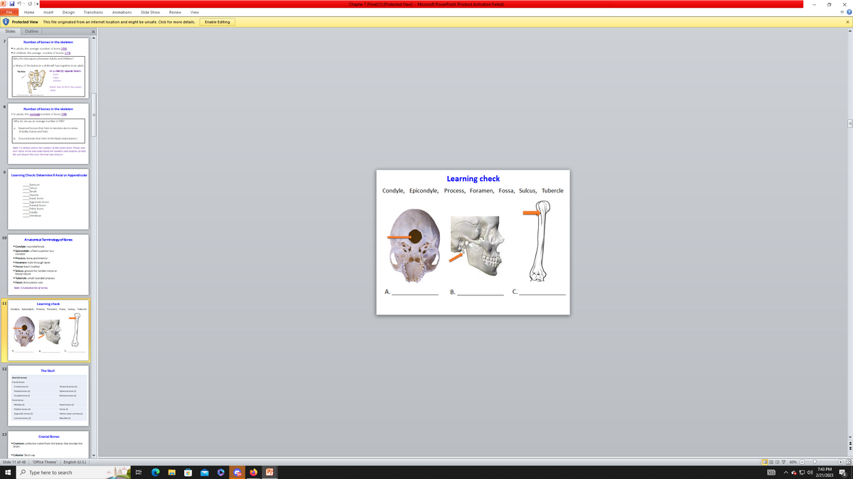 P
7
File
Protected View
Slides Outline
9
10
11
12
13
Home
+
Number of bones in the skeleton
In adults the average number of bone 206.
In children the average number of bones 270.
Why the discrepancy between Adults and Children?
a. Many of the bones in a child will fuse together in an adult.
In a child (3) separate bones
The Pelvis
Number of bones in the skeleton
• In adults the average number of bone 206
Why do we say an average number of 2067
a. Sesamoid bones that form in lendons due to stress
(Patella, hands and feet)
b. Sutural bones that form in the head (extra bones)
Table 7.1 details where the number of 206 comes from. Please look
over these terms and understand the numbers and location of each
We will dissect this over the next two lectures.
Insert Design Transitions
This file originated from an Internet location and might be unsafe. Click for more details.
Learning Check: Determine if Axial or Appendicular
Sternum
Femur
Tarsals
Skull (22 bones)
Cranial bones
Facial bones
Clavicle
Nasal bone
Frontal bone (
Pubis
lachium
Zygomatic bone
Parietal bone
Pelvic bone
Patella
Vertebrae
Anatomical Termindogy of Bones
Condyle: rounded knob
▪ Epicondyle: a flare superior to a
condyle
Adult: fuse to form hip (coxal)
bone
▪ Process: bony prominence
*Foramen: hole through bone
Fossa: basin (valley)
▪ Sulcus: groove for tendon nerve or
blood vessel
Tubercle: small rounded process
Facet: Articulation site
Table 7.2 detalled list of terms.
Learning check
Condyle, Epicondyle, Process, Foramen, Fossa, Sulcus, Tubercle
Parietal bones (2)
Occipital bone (1)
Slide 11 of 48
Palatine bones (2)
Zygomatic bones (2)
Lacrimal bones (2)
▪ Calvaria: Skull cap
The Skull
Temporal bones (2)
Sphenoid bone (1)
Ethmoid bones (2)
Cranial Bones
Cranium: collective name from the bones that enclose the
brain.
Nasal bones (2)
Vomer (
Inferior nasal concha (2)
Mandible (1)
"Office Theme" English (U.S.)
Type here to search
Animations
Slide Show
Review
View
Enable Editing
Ps
Chapter 7 (Final)(1) [Protected View] - Microsoft PowerPoint (Product Activation Failed)
Learning check
Condyle, Epicondyle, Process, Foramen, Fossa, Sulcus, Tubercle
A.
B.
2011
回: 60%
GE
I
(»)
7:43 PM
2/21/2023
x
X
+*