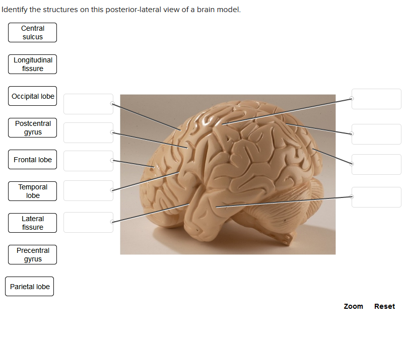 Identify the structures on this posterior-lateral view of a brain model.
Central
sulcus
Longitudinal
fissure
Occipital lobe
Postcentral
gyrus
Frontal lobe
Temporal
lobe
Lateral
fissure
Precentral
gyrus
Parietal lobe
Zoom Reset