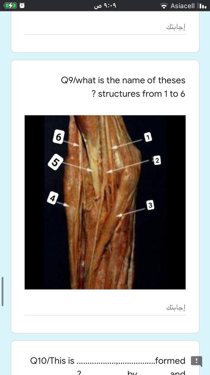 o 9:.9
* Asiacell Iı.
إجابتك
Q9/what is the name of theses
? structures from 1 to 6
61
3
إجابتك
Q10/This is
..formed
by
and
