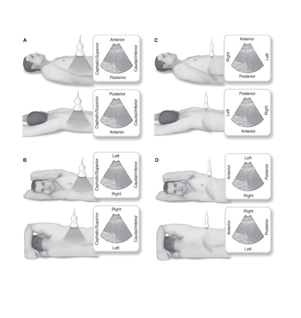 Anterior
Anterior
Posterior
Posterior
Posterior
Posterior
Anterior
Anterior
Left
Left
Right
Right
Left
Left
Cephalic/Superior
Cephalic/Superior
Cephalic/Superior
Cephalic/Superior
Caudal/Inferior
Caudal/Inferior
Caudal/Inferior
Caudal/Inferior
Anterior
Anterior
Left
Right
Posterior
Posterior
Right
Left
