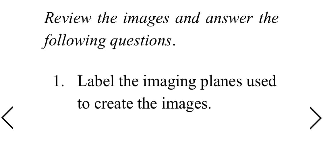 Review the images and answer the
following questions.
1. Label the imaging planes used
to create the images.
