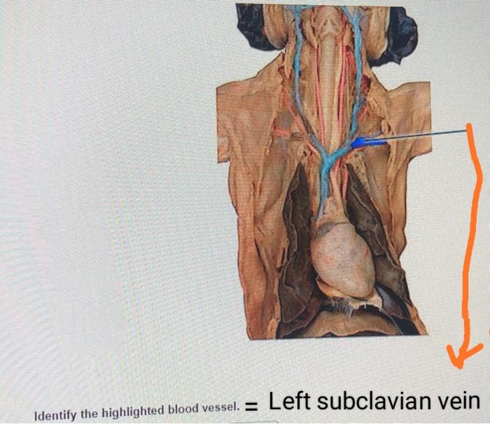 Left subclavian vein
Identify the highlighted blood vessel. =
