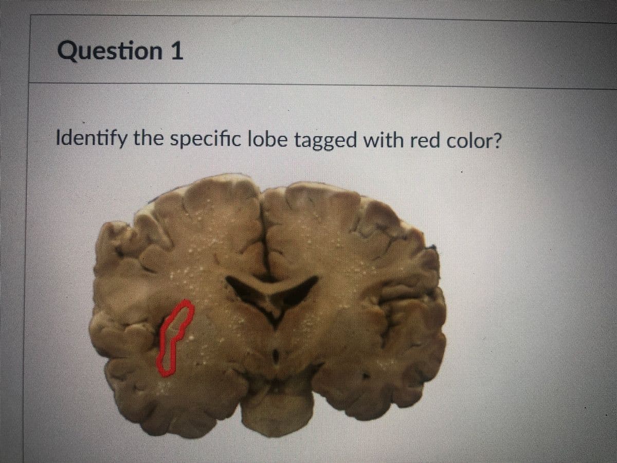 Question 1
Identify the specific lobe tagged with red color?
