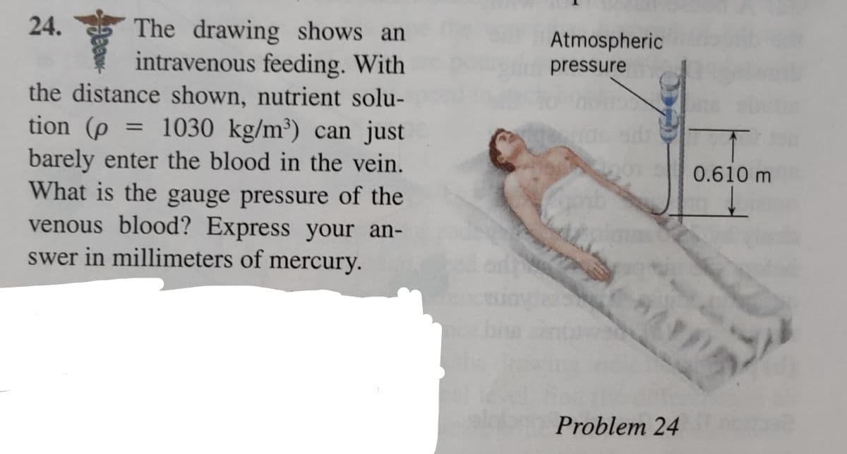 The drawing shows an
intravenous feeding. With
the distance shown, nutrient solu-
tion (p = 1030 kg/m³) can just
barely enter the blood in the vein.
What is the gauge pressure of the
venous blood? Express your an-
swer in millimeters of mercury.
24.
201
Atmospheric
pressure
Al
*
0.610 m
PAPA
Problem 24