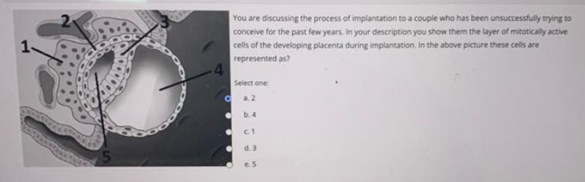 000000000000
4
You are discussing the process of implantation to a couple who has been unsuccessfully trying to
conceive for the past few years. In your description you show them the layer of mitotically active
cells of the developing placenta during implantation. In the above picture these cells are
represented as?
C
Select one:
a.2
b.4
c. 1
d. 3