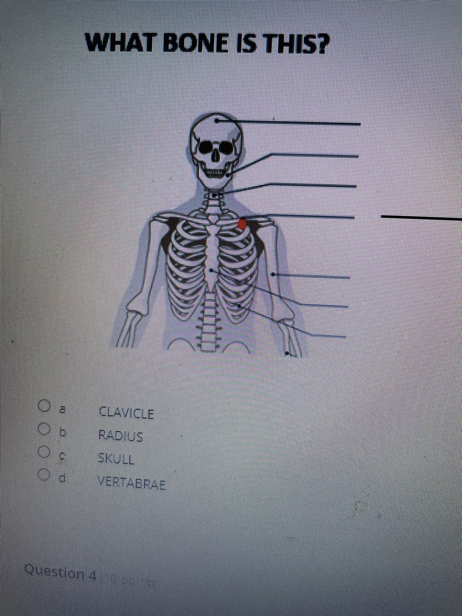 WHAT BONE IS THIS?
CLAVICLE
RADIUS
SKULL
VERTABRAE
Question 4 0conts
O0 0 0
