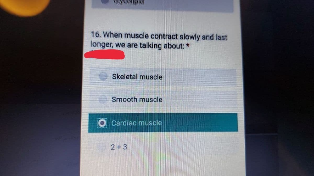 16. When muscle contract slowly and last
longer, we are talking about:
Skeletal muscle
Smooth muscle
O Cardiac muscle
2+3
