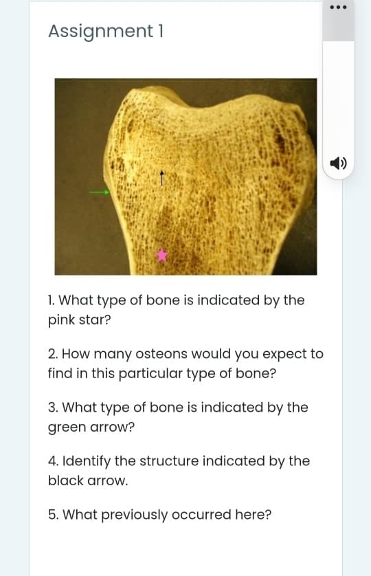 Assignment 1
1)
1. What type of bone is indicated by the
pink star?
2. How many osteons would you expect to
find in this particular type of bone?
3. What type of bone is indicated by the
green arrow?
4. Identify the structure indicated by the
black arrow.
5. What previously occurred here?
