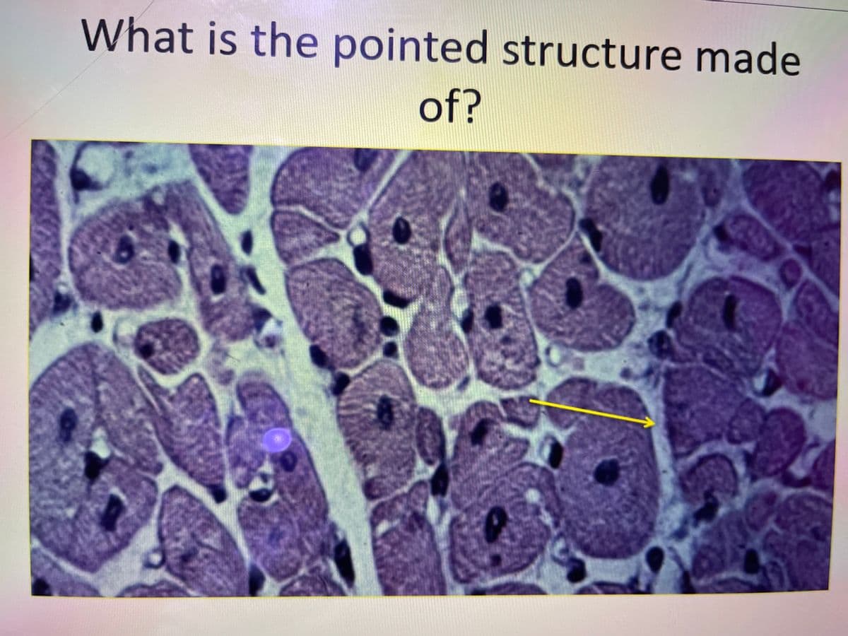 What is the pointed structure made
of?
