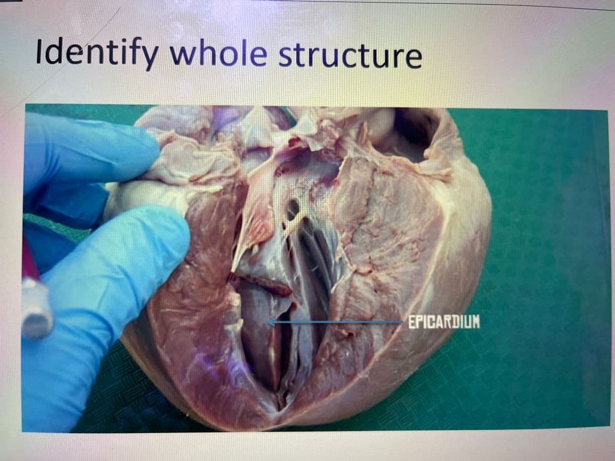 Identify whole structure
EPICARDIUM
Es
