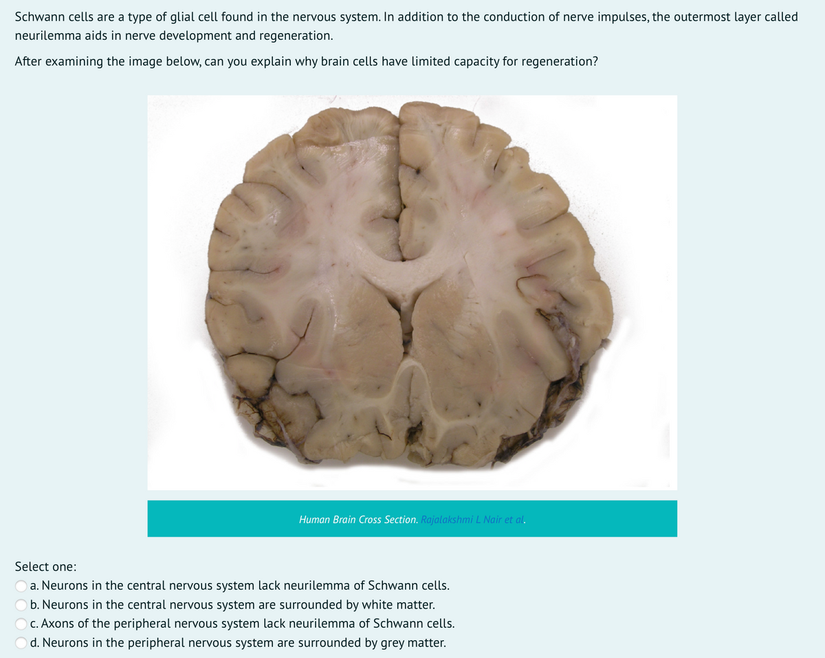 Schwann cells are a type of glial cell found in the nervous system. In addition to the conduction of nerve impulses, the outermost layer called
neurilemma aids in nerve development and regeneration.
After examining the image below, can you explain why brain cells have limited capacity for regeneration?
Human Brain Cross Section. Rajalakshmi L Nair et al.
Select one:
a. Neurons in the central nervous system lack neurilemma of Schwann cells.
b. Neurons in the central nervous system are surrounded by white matter.
c. Axons of the peripheral nervous system lack neurilemma of Schwann cells.
d. Neurons in the peripheral nervous system are surrounded by grey matter.
