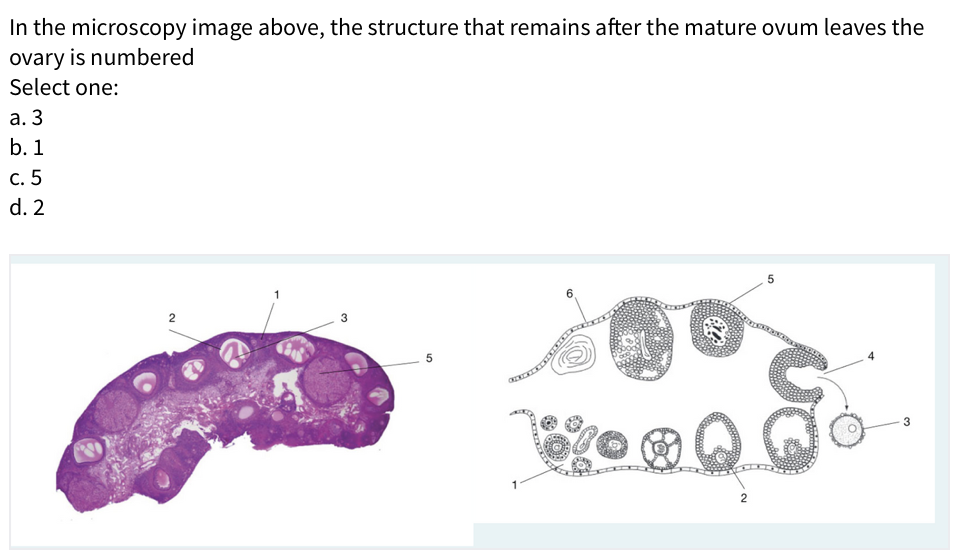 In the microscopy image above, the structure that remains after the mature ovum leaves the
ovary is numbered
Select one:
а. 3
b. 1
с. 5
d. 2
5
3
