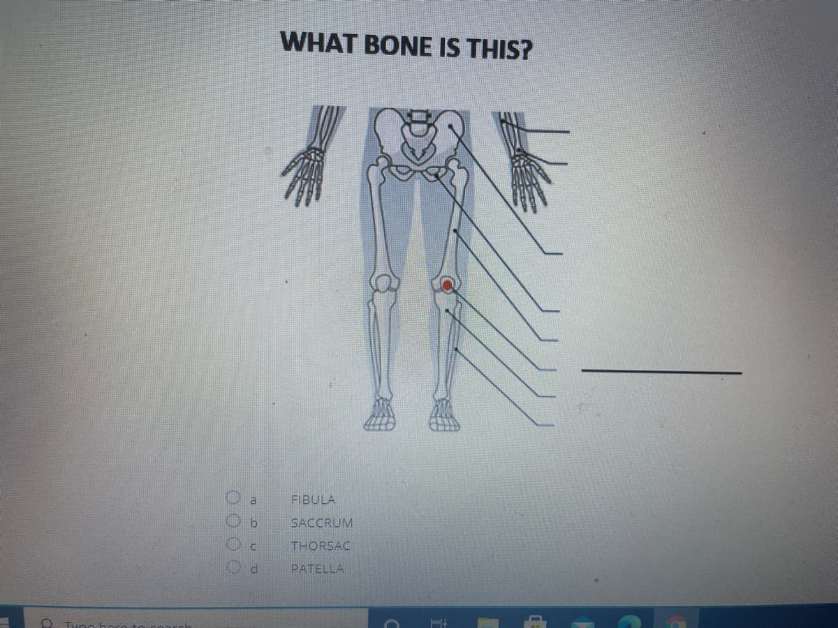 WHAT BONE IS THIS?
a
FIBULA
SACCRUM
THORSAC
PATELLA
O O OO
