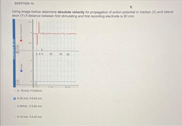 QUESTION 14
Using image bellow determine absolute velocity for propagation of action potential in median (X) and lateral
axon (Y) if distance between first stimulating and first recording electrode is 90 mm.
PUNESTOTONS LASTOISE
200
+0
Acto Penal
Sons
B
3
15
245 10
X- 18 m/s; Y-5.62m/s
X-30 m/s; Y-6.42 m/s
X-30m/s : Y-5.62 m/s
X-18 m/s; Y-6.42 m/s
16 20