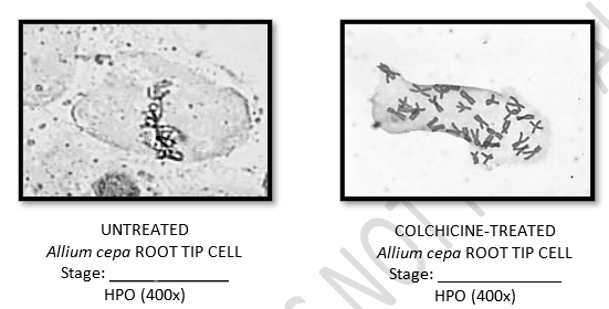 UNTREATED
COLCHICINE-TREATED
Allium cepa ROOT TIP CELL
Stage:
НРО (400х)
Allium cера ROOT TIP СELL
Stage:
НРО (400х)
