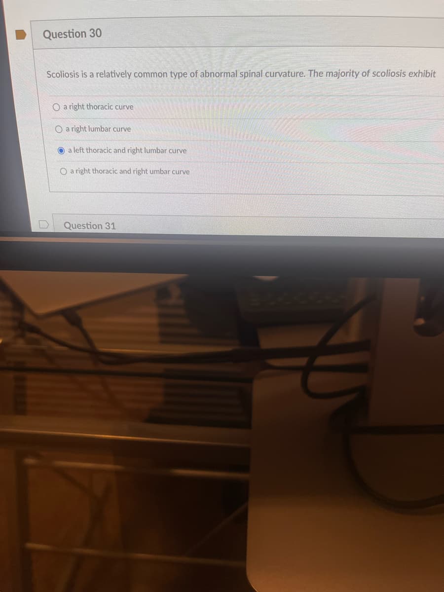 Question 30
Scoliosis is a relatively common type of abnormal spinal curvature. The majority of scoliosis exhibit
O a right thoracic curve
O a right lumbar curve
a left thoracic and right lumbar curve
O a right thoracic and right umbar curve
Question 31
