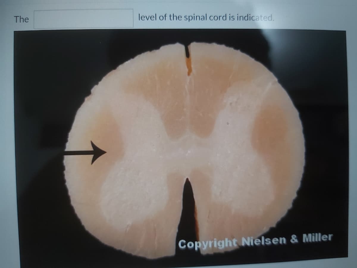 The
level of the spinal cord is indicated.
Copyright Nielsen & Miller
