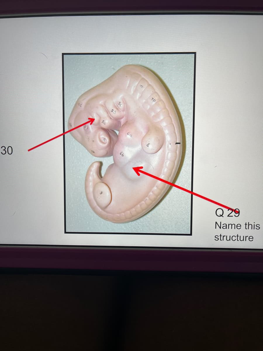 TO
Q 29
Name this
structure
30
