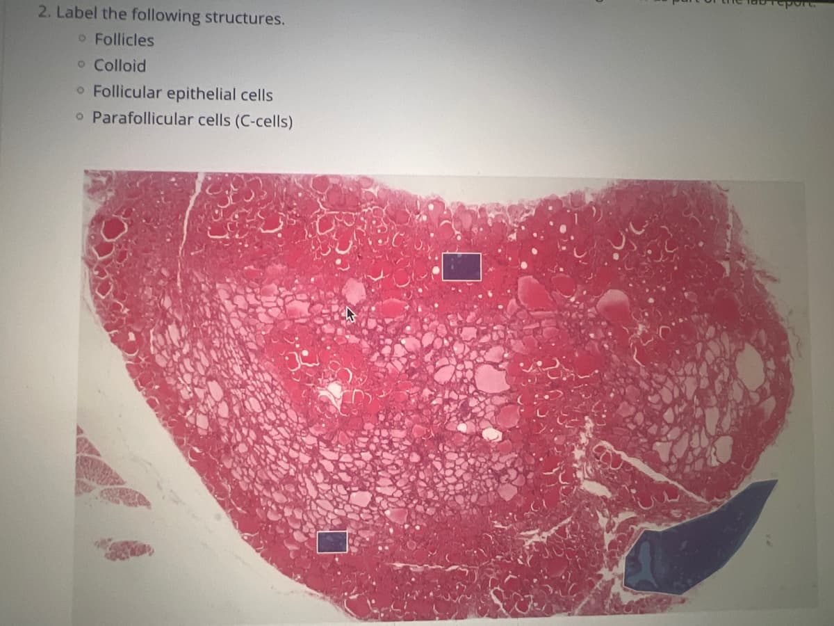 2. Label the following structures.
Follicles
O Colloid
O Follicular epithelial cells
o Parafollicular cells (C-cells)