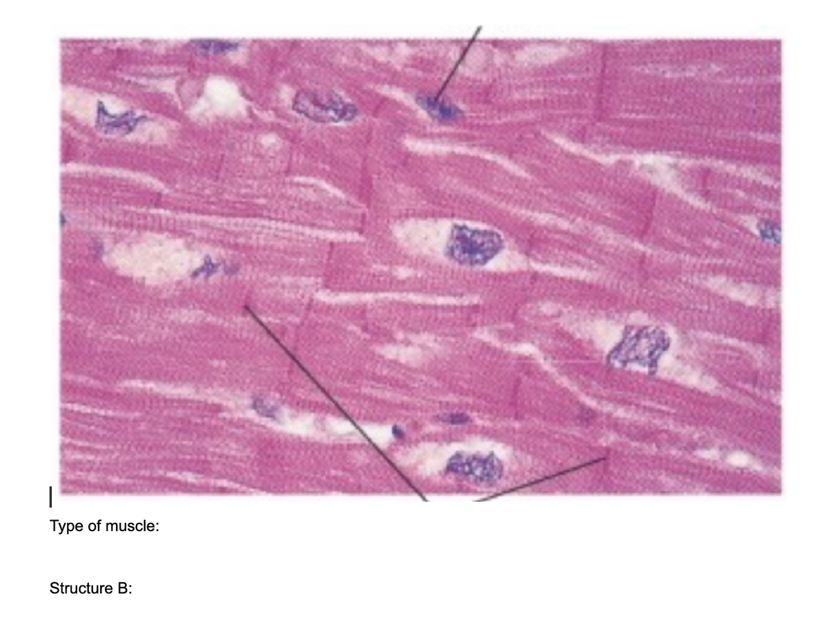 Type of muscle:
Structure B:
