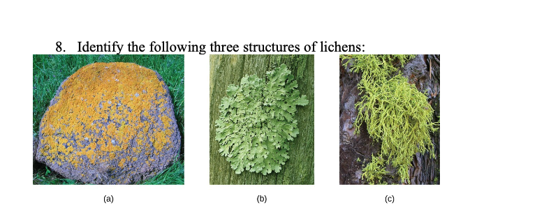 8. Identify the following three structures of lichens:
(a)
(b)
(c)
