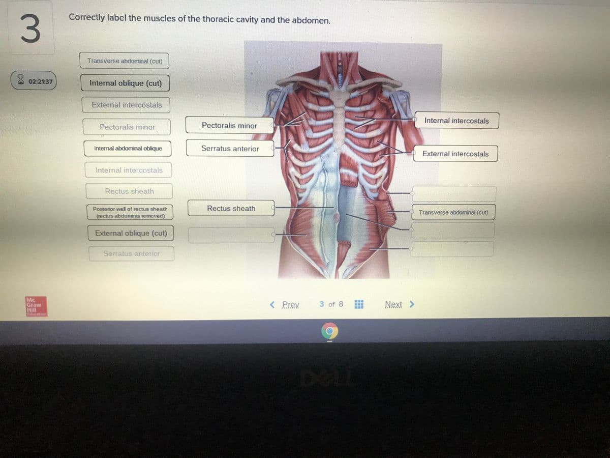 Correctly label the muscles of the thoracic cavity and the abdomen.
3.
Transverse abdominal (cut)
02:21:37
Internal oblique (cut)
External intercostals
Internal intercostals
Pectoralis minor
Pectoralis minor
Internal abdominal oblique
Serratus anterior
External intercostals
Internal intercostals
Rectus sheath
Rectus sheath
Postenor wal of rectus sheath
(rectus abdominis removed)
Transverse abdominal (cut)
External oblique (cut)
Serratus anterior
Mc
Graw
Hill
docation
Prey
3 of 8
Next >
DELL
業
