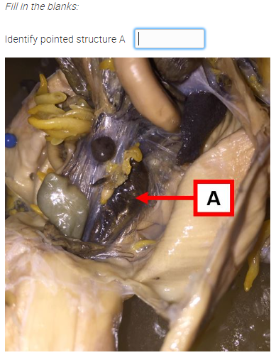 Fill in the blanks:
Identify pointed structure A
A