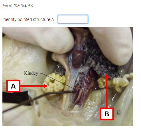 Fill in the blanks:
Identify pointed structure A
Kindey
A
B