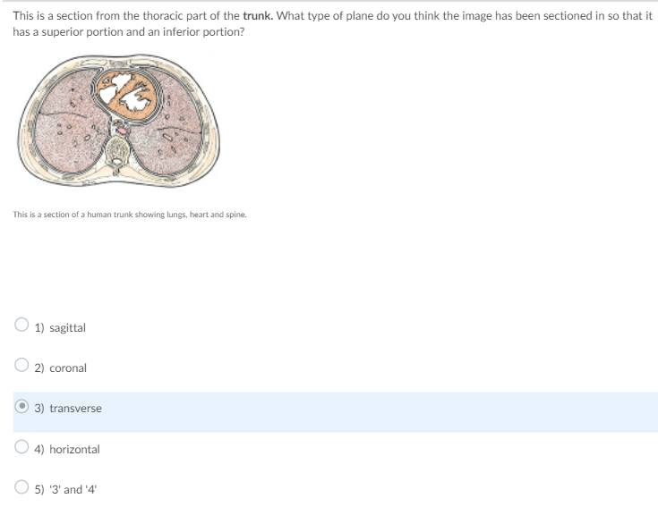 This is a section from the thoracic part of the trunk. What type of plane do you think the image has been sectioned in so that it
has a superior portion and an inferior portion?
This is a section of a human trunk showing lungs, heart and spine.
1) sagittal
2) coronal
3) transverse
4) horizontal
5) '3' and '4'