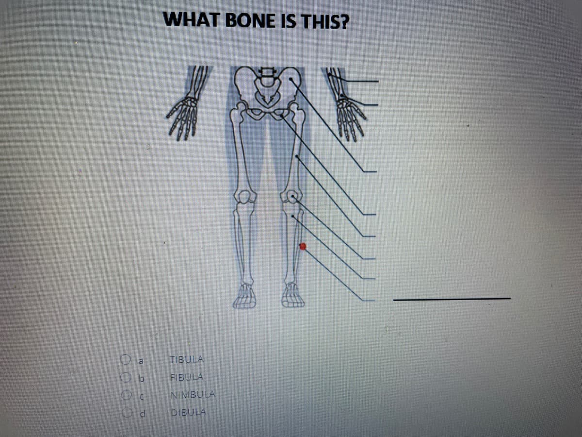 WHAT BONE IS THIS?
TIBULA
FIBULA
NIMBULA
DIBULA
0000
