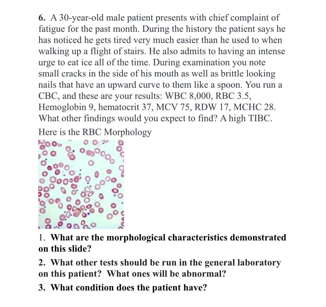 6. A 30-year-old male patient presents with chief complaint of
fatigue for the past month. During the history the patient says he
has noticed he gets tired very much easier than he used to when
walking up a flight of stairs. He also admits to having an intense
urge to eat ice all of the time. During examination you note
small cracks in the side of his mouth as well as brittle looking
nails that have an upward curve to them like a spoon. You run a
CBC, and these are your results: WBC 8,000, RBC 3.5,
Hemoglobin 9, hematocrit 37, MCV 75, RDW 17, MCHC 28.
What other findings would you expect to find? A high TIBC.
Here is the RBC Morphology
1. What are the morphological characteristics demonstrated
on this slide?
2. What other tests should be run in the general laboratory
on this patient? What ones will be abnormal?
3. What condition does the patient have?