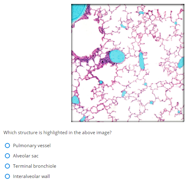 Which structure is highlighted in the above image?
O Pulmonary vessel
O Alveolar sac
O Terminal bronchiole
O Interalveolar wall
