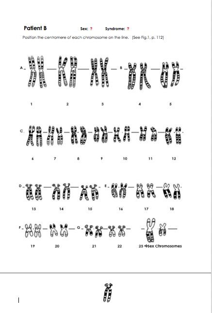 Patient B
Sex: ?
Syndrome: ?
Position the centromere of each chromosome on the line. (See Fig.1, p. 112)
10
__身,想烈_雙號_剪象。
13
14
15
16
17
18
19
20
21
22
23 sex Chromosomes
