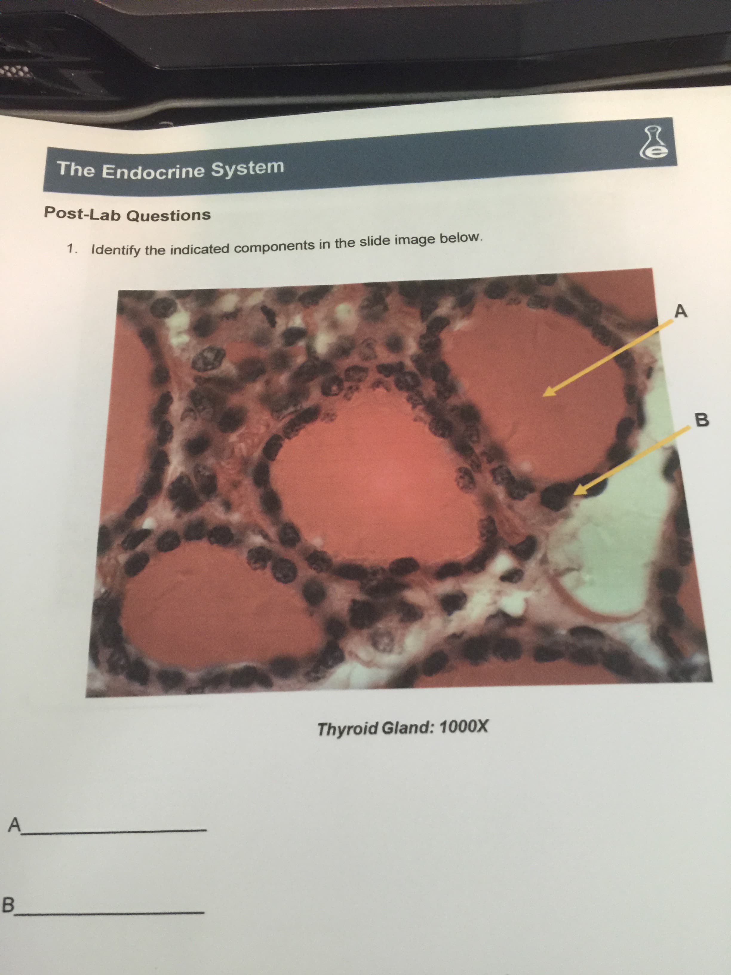 1. Identify the indicated components in the slide image below.
A
Thyroid Gland: 1000X
