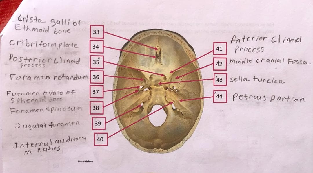 Grista galli of
Ethmoid bone
812
33
Anterior clinoid
process
cribriformplete
34
41
Posteriorelinoid
process
35
42
middle cranial Fossa
Foramen rotandum 36
43 sella turcica
Foramen ovale of
37
Sphenoid bene
44
petrous portion
38
Foramen spinosum
39
Jugularforamen
Internal auditory
meatus
40
Mark Nielsen
