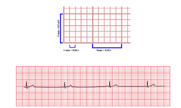 I mm - 0.04 s
Smm - 0.20 s
