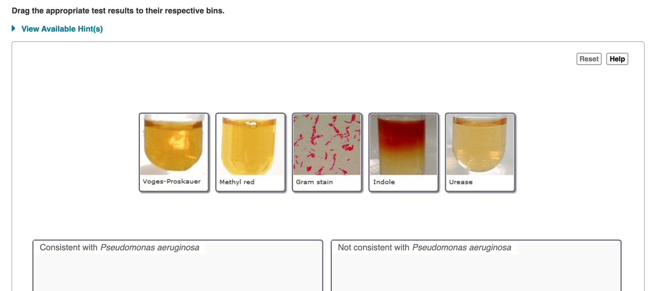 Voges-Proskauer
Methyl red
Gram stain
Indole
Urease
Consistent with Pseudomonas aeruginosa
Not consistent with Pseudomonas aeruginosa
