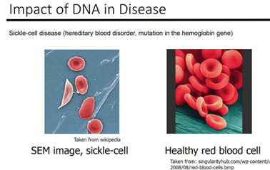 Impact of DNA in Disease
Sickle-cell disease (hereditary blood disorder, mutation in the hemoglobin gene)
Taken from wikipedia
SEM image, sickle-cell
Healthy red blood cell
Taken from: singularityhub.com/wp-content/u
2008/08/red-blood-cells.bmp