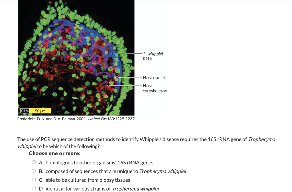 T. whipplei
RNA
-Host nuclei
- Host
cytoskeleton
CFM 50 μm
Fredericks, D. N. and D. A. Belman. 2001. J Infect Dis 183:1229-1237
The use of PCR sequence detection methods to identify Whipple's disease requires the 16S rRNA gene of Tropheryma
whipplei to be which of the following?
Choose one or more:
A. homologous to other organisms' 16S rRNA genes
OB. composed of sequences that are unique to Tropheryma whipplei
OC. able to be cultured from biopsy tissues
OD. identical for various strains of Tropheryma whipplei