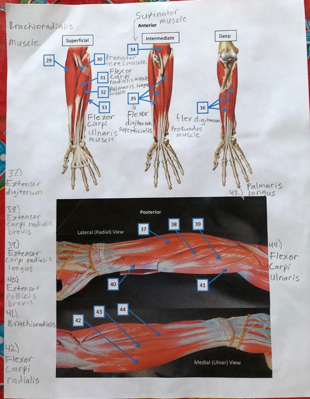 Supinator
muscle
Brachioradialis
Anterior
Deep
Intermediate
muscle
Superficial
34
30 Pronator
Heresmusle
Flexor
31 Carpi
radialis muscld
29
Palmaris longue
32
muscle
35
33
36
Flexor
digitorun
Fle xor
flex digitorcom
carpi
iaris Superficialis
Profundus
muscle
muscle
37.)
Extensor
digitorum
Palmaris
43.) 1ongus
38)
Extensor
Carpi radialis
brevis
Posterior
38
39
37
Lateral (Radial) View
31.
Extensor
Carpi radiali's
Tongus
40.1
Extensor
Pollicis
brevis
44)
Flexor
Carpi
julnaris
40
41
44
43
Brachioradialis
42
Flexor
Carpi
radialis
Medial (Ulnar) View
