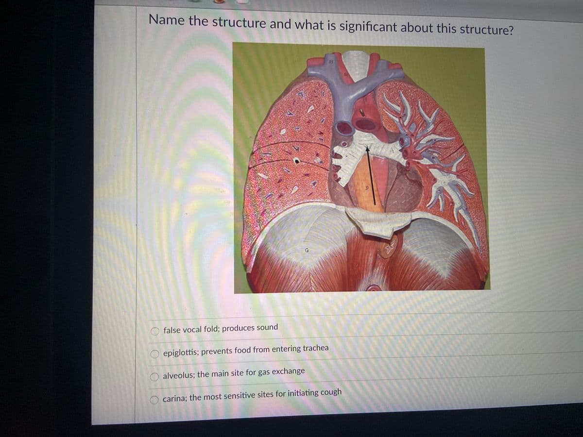 Name the structure and what is significant about this structure?
false vocal fold; produces sound
epiglottis; prevents food from entering trachea
alveolus; the main site for gas exchange
O carina; the most sensitive sites for initiating cough
