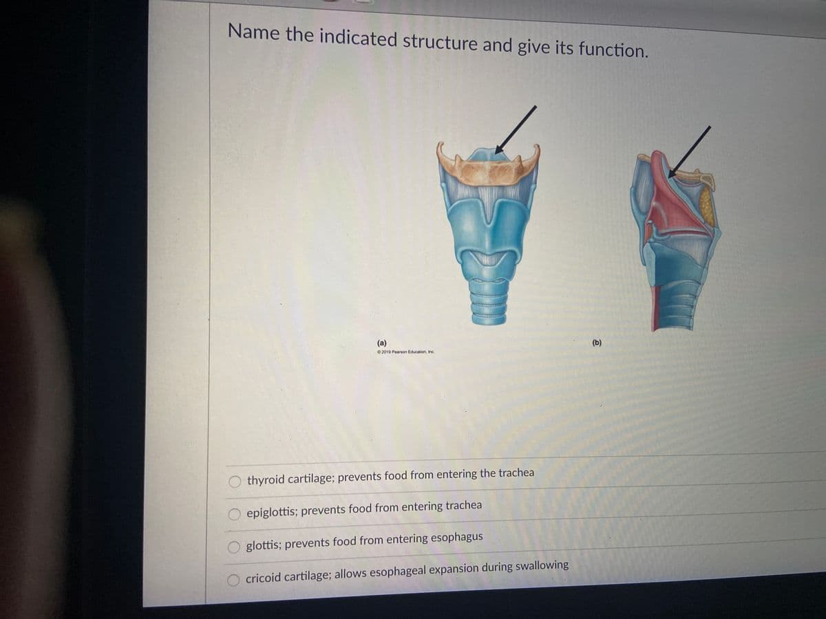 Name the indicated structure and give its function.
(a)
(b)
2019 Pearson Education, Inc.
thyroid cartilage; prevents food from entering the trachea
epiglottis; prevents food from entering trachea
glottis; prevents food from entering esophagus
cricoid cartilage; allows esophageal expansion during swallowing
