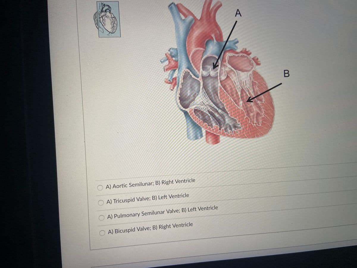 O A) Aortic Semilunar; B) Right Ventricle
OA) Tricuspid Valve; B) Left Ventricle
O A) Pulmonary Semilunar Valve; B) Left Ventricle
A) Bicuspid Valve; B) Right Ventricle
