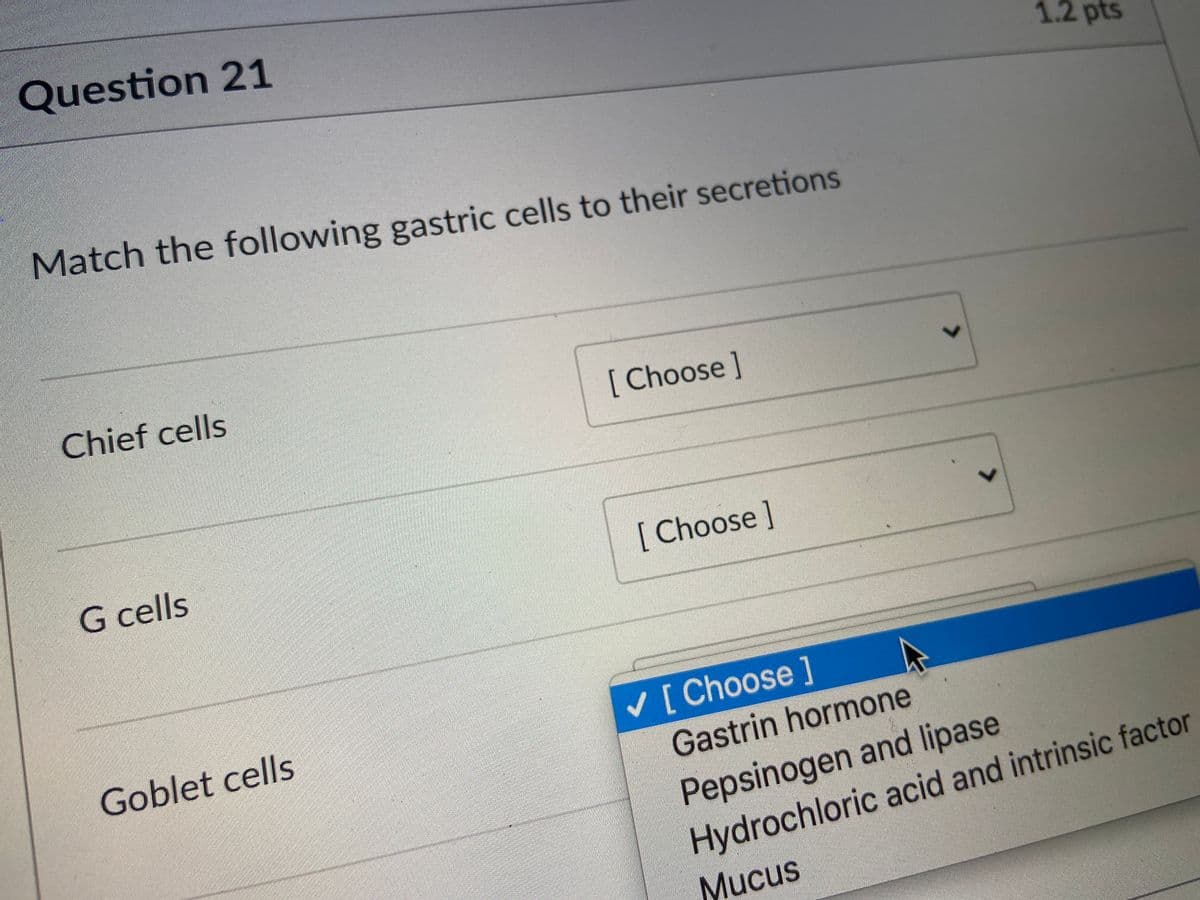 Question 21
1.2 pts
Match the following gastric cells to their secretions
Chief cells
[Choose]
G cells
[ Choose ]
Goblet cells
V [ Choose ]
Gastrin hormone
Pepsinogen and lipase
Hydrochloric acid and intrinsic factor
Mucus
<>
