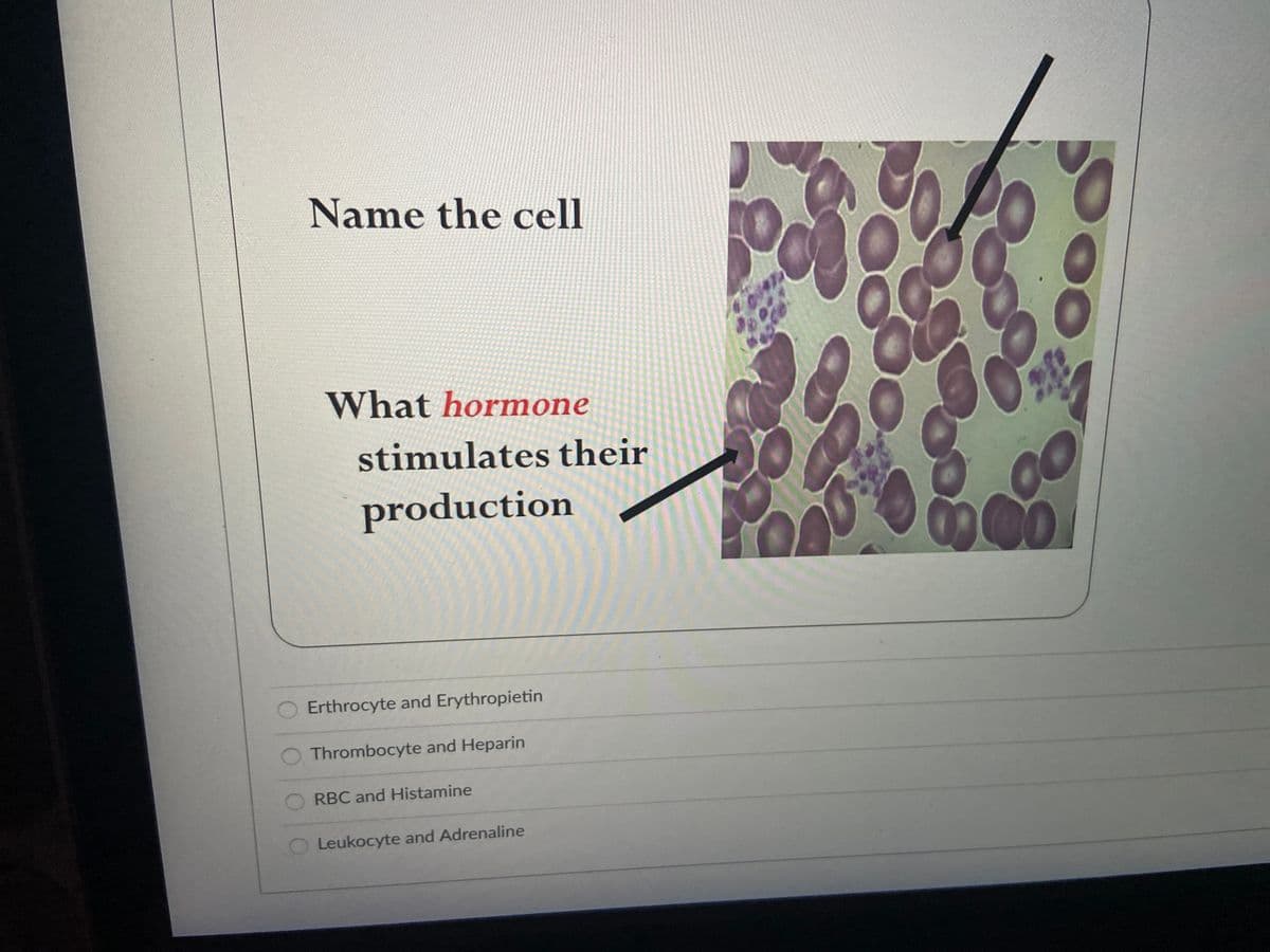 Name the cell
What hormone
stimulates their
production
Erthrocyte and Erythropietin
O Thrombocyte and Heparin
RBC and Histamine
Leukocyte and Adrenaline
